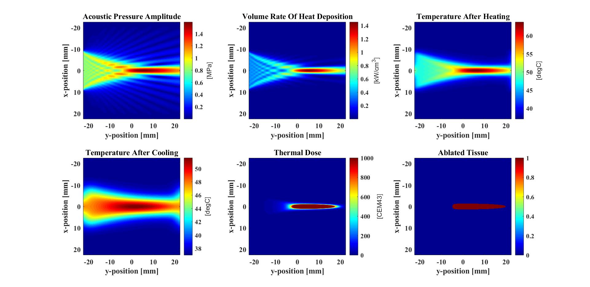 The resulting pressure, volume rate of heat deposition, 
                                                            temperature field, thermal dose, and ablation volume